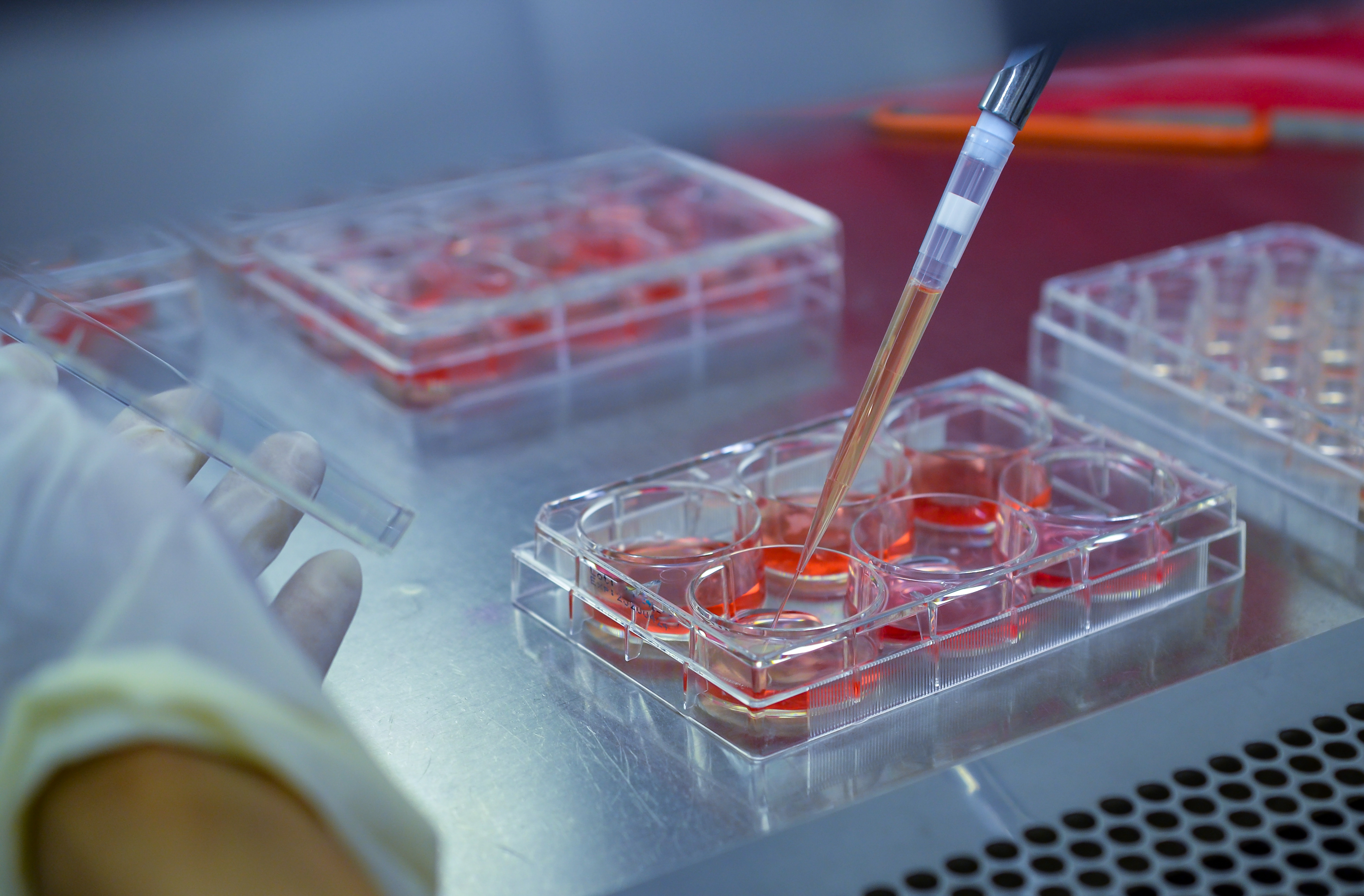 Pancreatic adenocarcinoma Cell culture